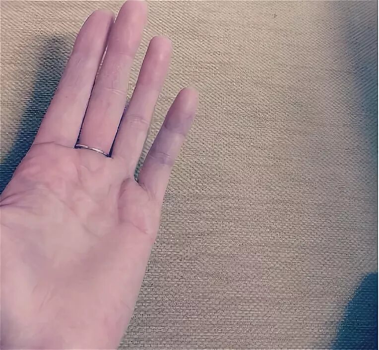 Как выглядит мизинец. Перелом среднего пальца на руке. Как выглядит мизинец. Перелом мизинцамизинца на руее. Как выглядит мизинец.