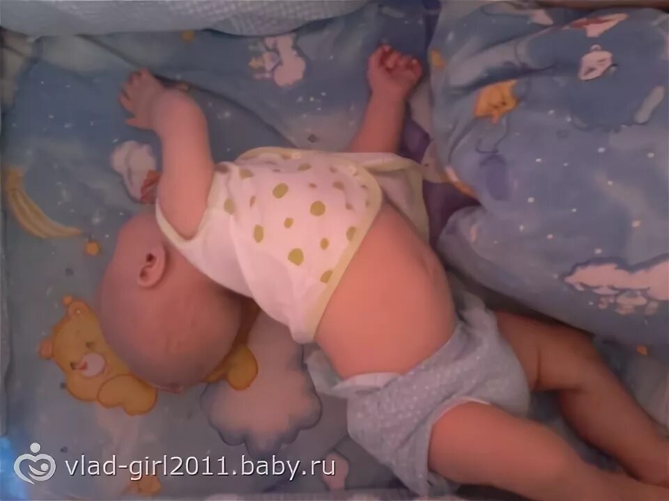 Почему ребенок запрокидывает