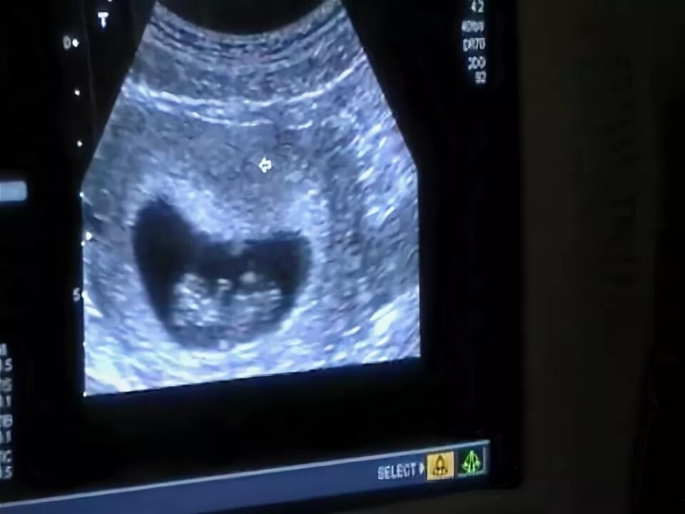 Was 10 in weeks. Was 10 in weeks