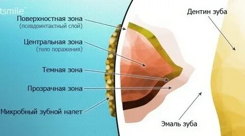 Поверхностная зона