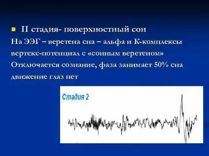 Поверхностный сон