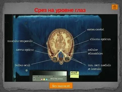 Срез человека