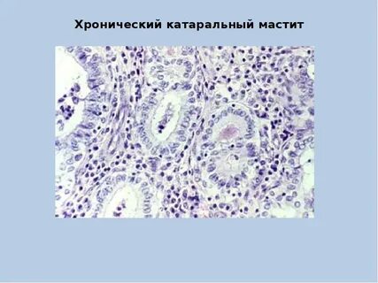 Катарально гнойный