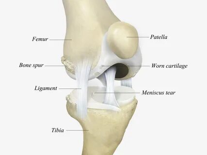 Patella
