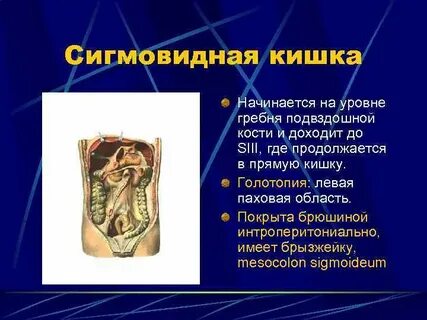 Левая подвздошная кишка