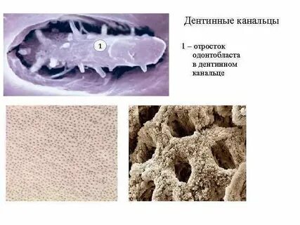 Одонтобласты пульпы
