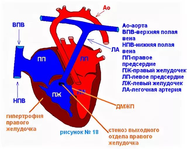 3 в правое предсердие впадает. Полые вены впадают в правый желудочек. Верхняя полая Вена правое предсердие. Правый желудочек и легочная артерия. Нижняя полая Вена впадает в левое предсердие.