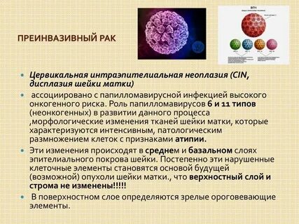 Неоплазия высокой степени шейки матки
