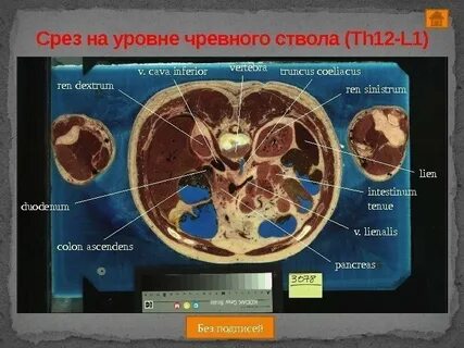 Уровень среза