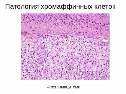 Хромафинные клетки