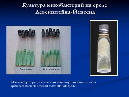 Микобактерии туберкулеза питательные среды