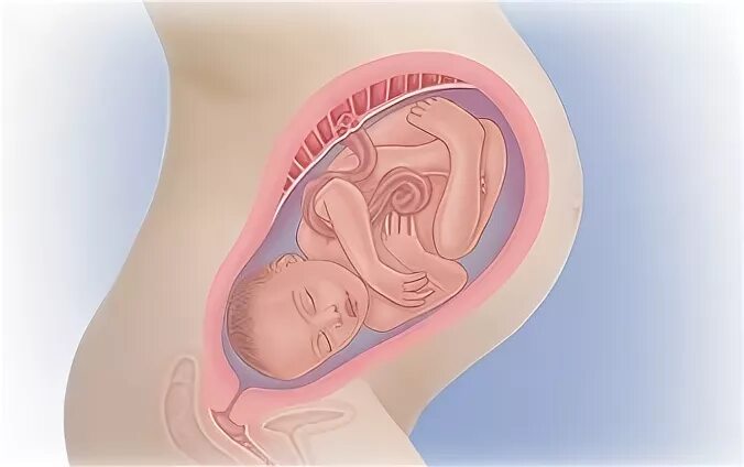 Расположение ребенка на 35 неделе. Расположение ребенка на 34 неделе беременности. Ребенок в животе на 34 неделе. 35 недель слабость
