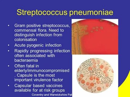 S pneumoniae