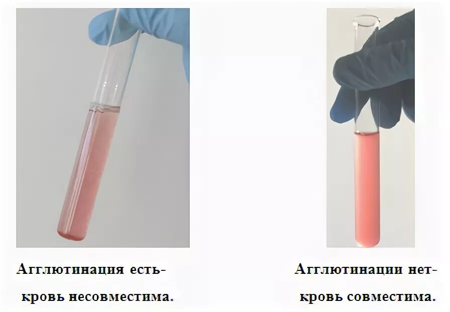 Проба на совместимость по резус фактору