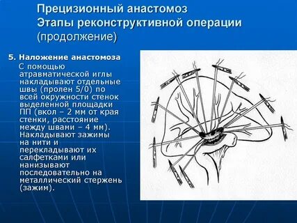 Продолжение операции