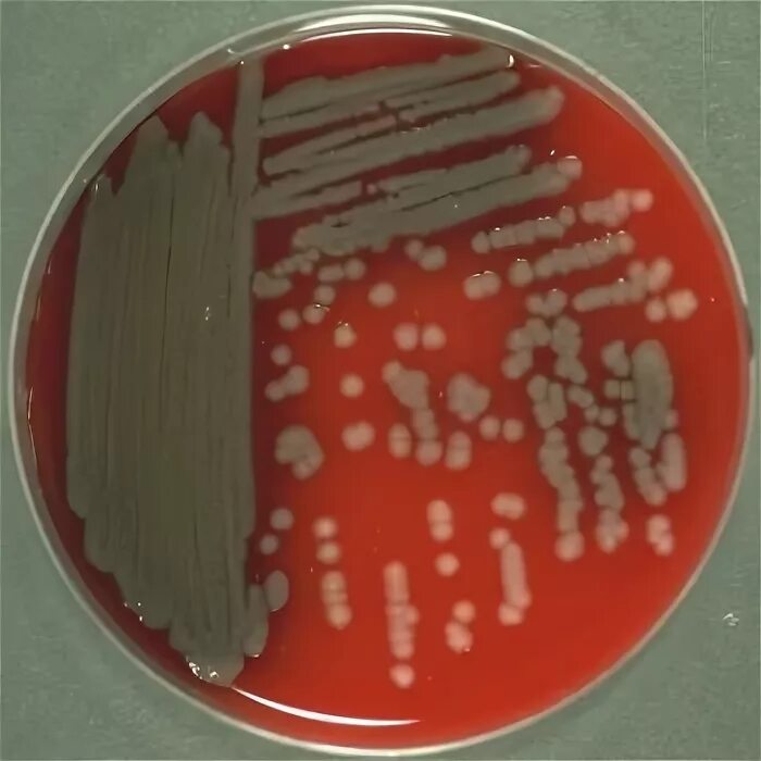 Pseudomonas spp что это. Псевдомонады (синегнойная палочка). пиоцианин pseudomonas aeruginosa. синегнойная палочка на кровяном агаре. синегнойная палочка колонии.