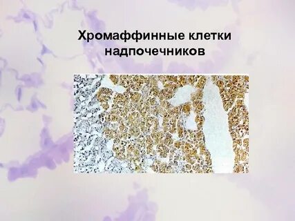 Хромафинные клетки