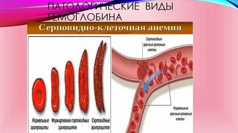 Гемоглобин виды