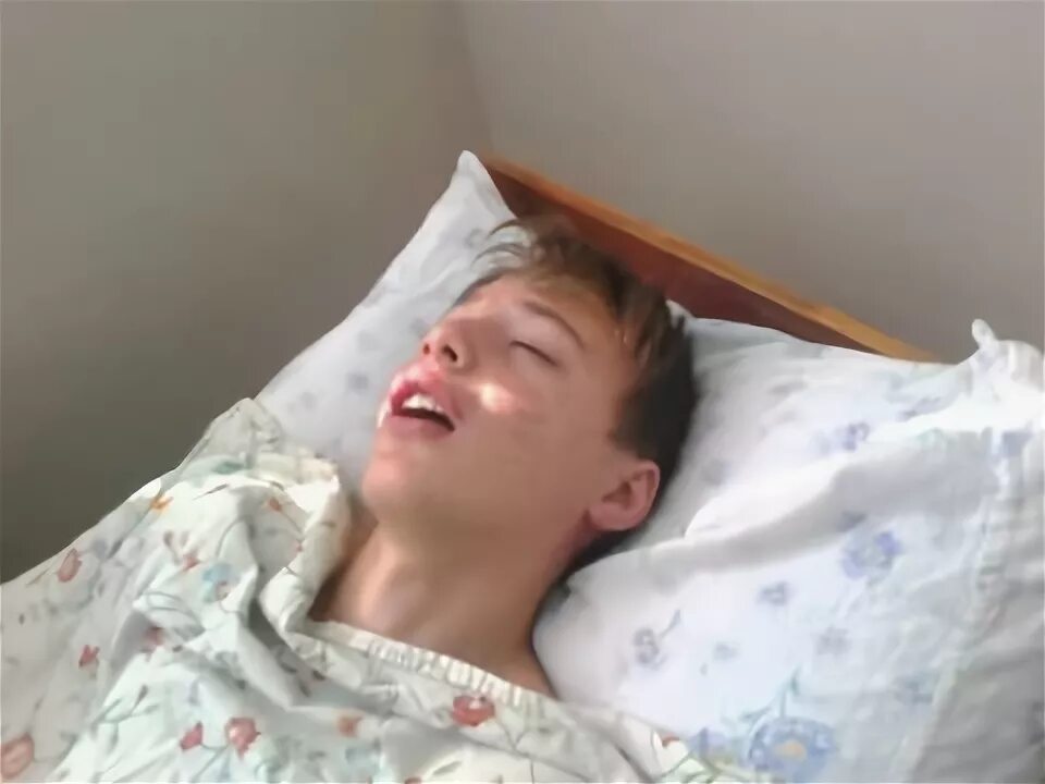 Сколько просыпаются после наркоза общего. Поллюционный сон. поллюционный сон у мальчиков подростков. парень отходит от наркоза.