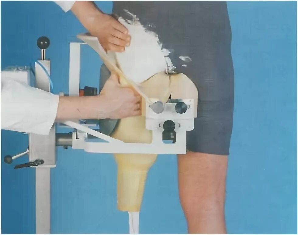 Вакуумный протез голени. Силиконовые протезы ног. Протез ноги. Протез бедра немодульный. Гильза марло протеза бедра.