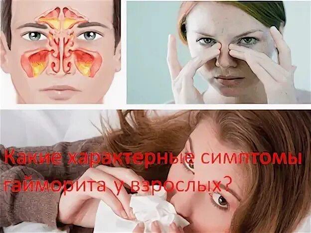 Признаки гайморита у взрослых с температурой