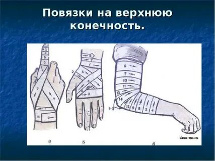 Повязки при отморожении пальцев