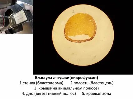 Самые маленькие размеры имеет яйцеклетка трески лягушки