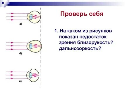 Глаз дефекты зрения физика 9 класс