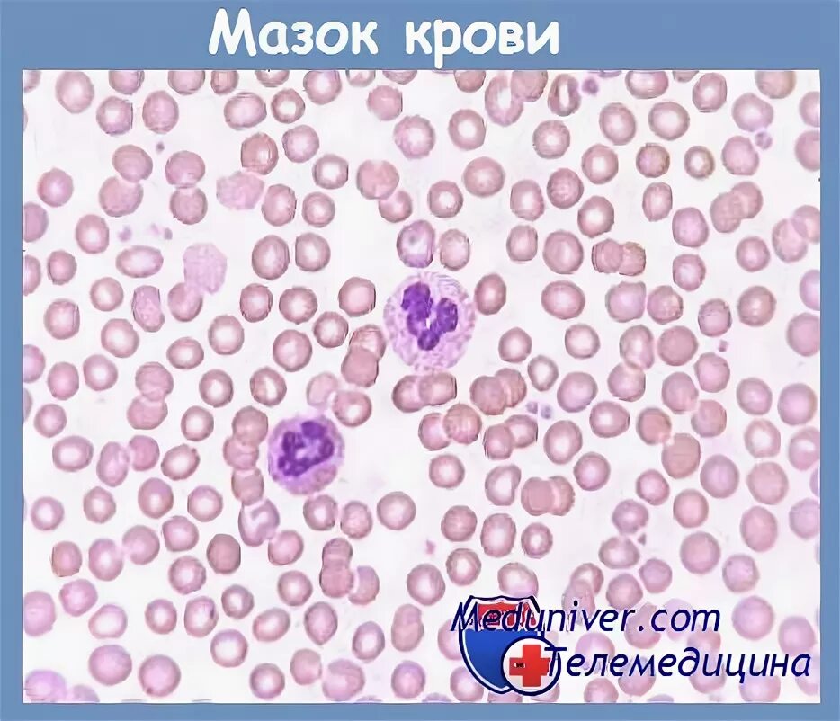 В мазке эритроциты что значит. В мазке эритроциты что значит