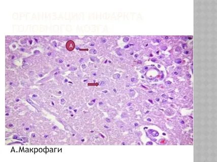 Макрофаги селезенки