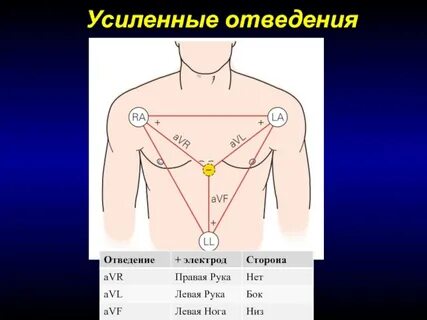 Система сбора и отведения