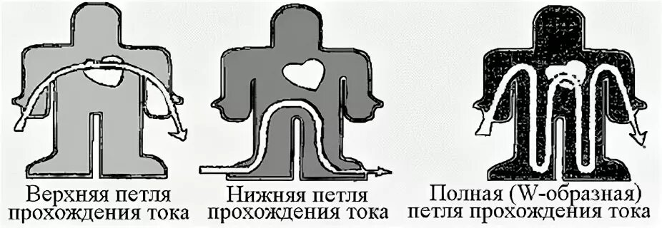 Какие петли тока наиболее опасны. Наиболее опасный путь протекания тока через тело человека. Электротравма петля тока. Путь («петля») тока через тело человека. Пути прохождения электрического тока через тело.