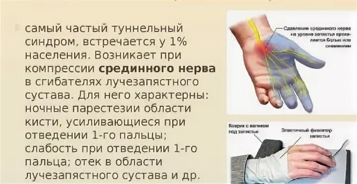 Немеет палец на правой руке большой причины