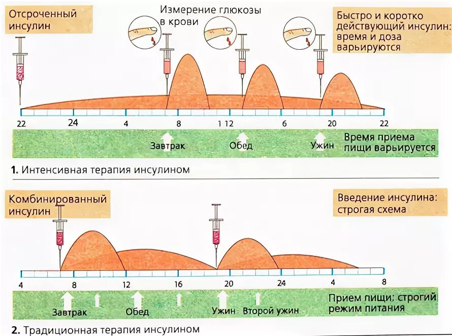 Схема введения инсулина при сахарном диабете 1. Инсулинотерапия при сахарном диабете 1 типа схема. Схема введения инсулина короткого действия. Схема приема инсулина при диабете 1 типа.