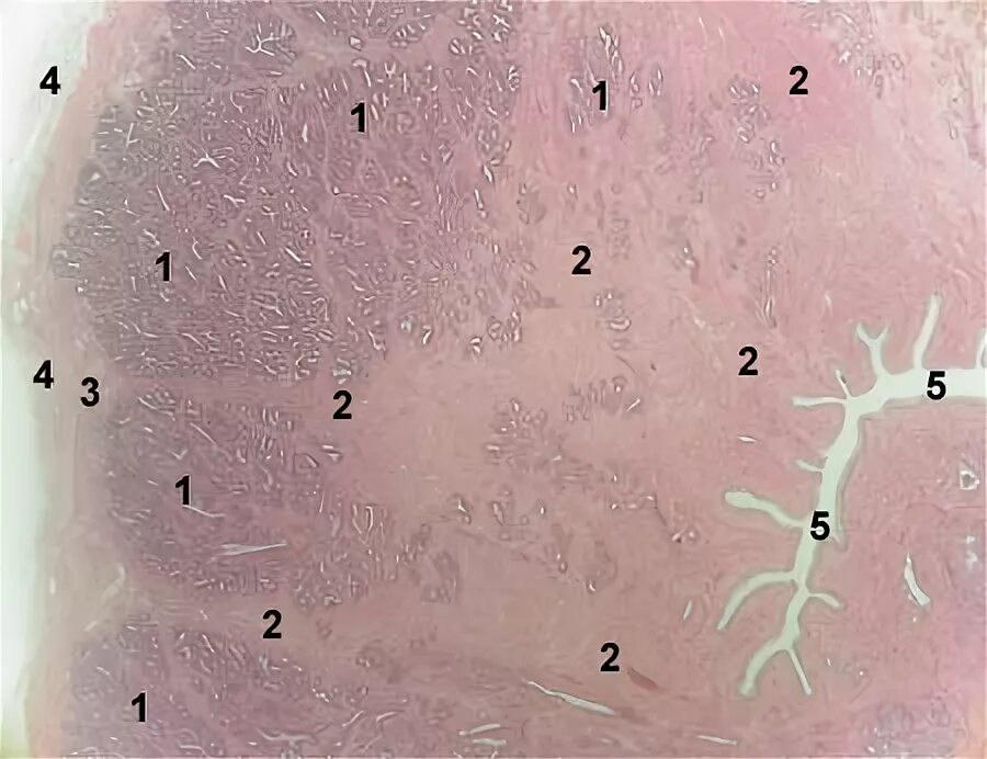 Простата гистология препарат. Предстательная железа гистология препарат. Простатическая железа гистология препарат. Предстательная железа гематоксилин эозин.