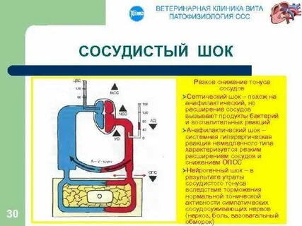 Шок кровообращения