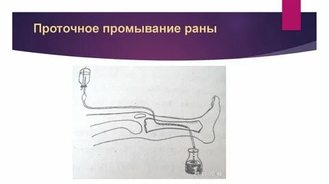 Чем промыть гной
