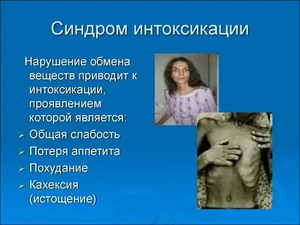 Синдром к
