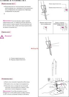Игла установка
