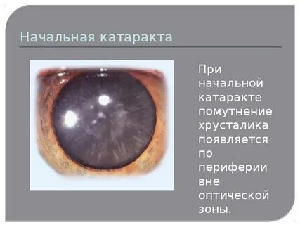 Катаракта кто делал отзывы