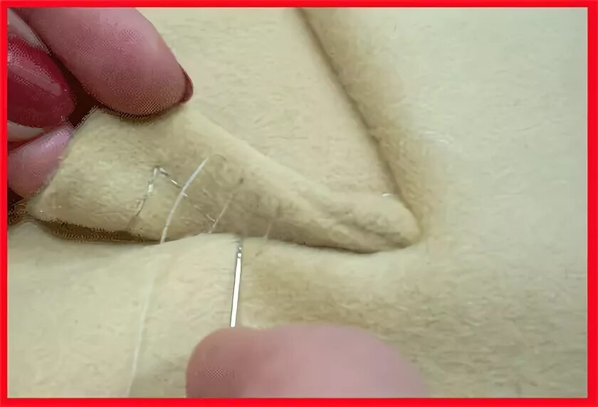 возможно ли пришить. возможно ли пришить.