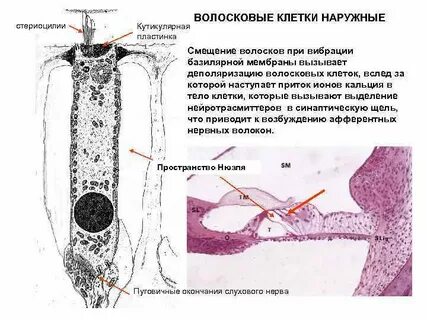 Волосковая сенсорная клетка