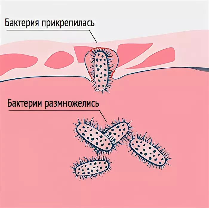 Цистит после после полового акта. Цистит вызывается бактериями. Цистит бактерии. Бактерии вызывающие цистит у женщин. Классификация цистина.