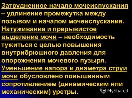 Начало мочеиспускания