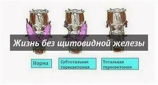 Жизнь без железа