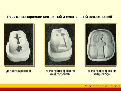 Помощь блэку