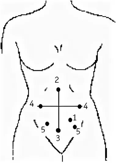 Точки на животе. Массажные точки на животе. Массаж живота по точкам. Точки на животе для массажа.