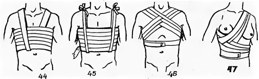 Повязка на молочные железы алгоритм. Бинтовая спиральная повязка перелом ребер. Десмургия грудной клетки. Спиральная повязка на грудную клетку с портупеей. Бинтовые повязки грудной клетки и живота.