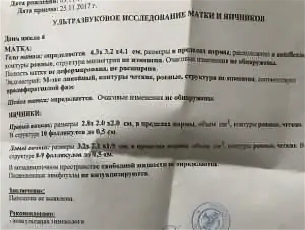 Размеры правого и левого яичника