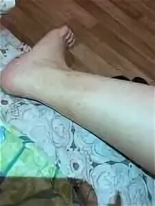 Точки внизу на ногах